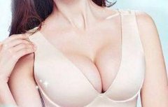 假體隆胸會影響哺乳嗎會變形嗎