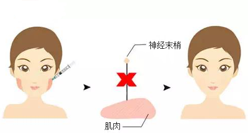 武漢美萊瘦臉需要注意事項(xiàng)有哪些