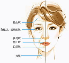 激光除皺的效果可以維持多久