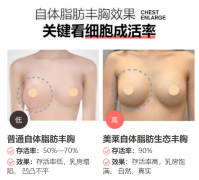 昭通做自體脂肪豐胸，怎么提高脂肪存活率