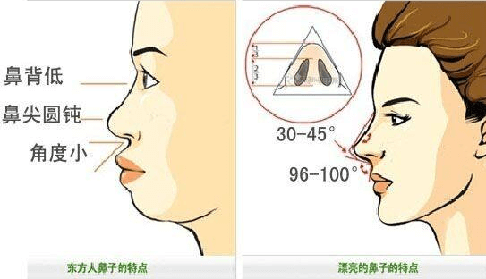 成都做玻尿酸隆鼻手術(shù)有哪些優(yōu)勢