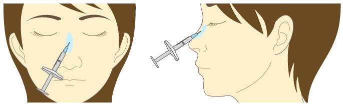 長(zhǎng)沙哪些鼻型適合注射玻尿酸