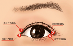 石家莊開眼角恢復(fù)時間內(nèi)可帶眼鏡嗎