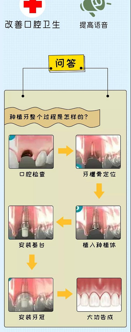 牙齒矯正可以用一輩子嗎？