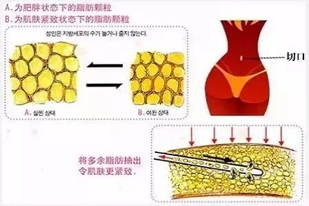 四月不吸脂，五、六、七月徒傷悲......