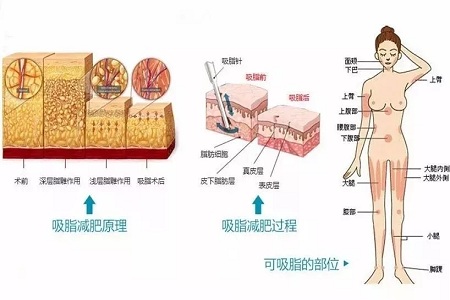 四月不吸脂，五、六、七月徒傷悲......