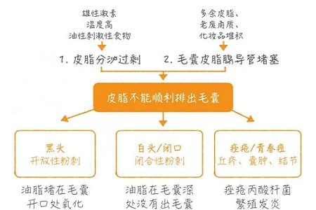 擠痘竟然被送進(jìn)ICU！你的痘痘還好嗎？