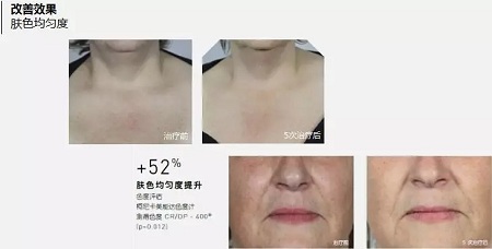 抗衰老的“水光”究竟為何飽受稱贊？