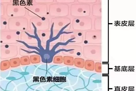 祛斑偏方“害死人”，小仙女們可長點心吧！