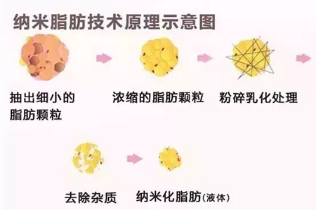 拿什么拯救你，我的黑眼圈？