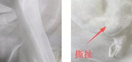 為什么瘦人也會(huì)有“肥胖紋”？