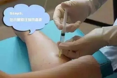 這有一個快速又持久瘦小腿的方法！請注意查收！