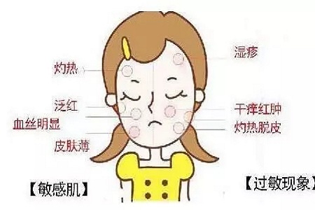 皮膚變成敏感肌怎么辦？如何修復(fù)敏感??？