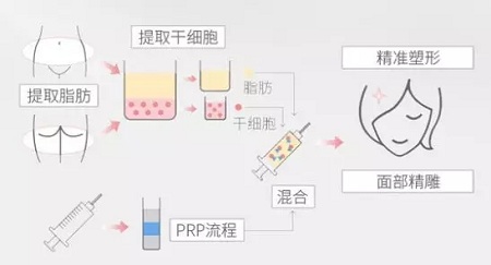 美萊實驗室：瘦臉、ReFa都解決不了你的臉大問題交給我就對了