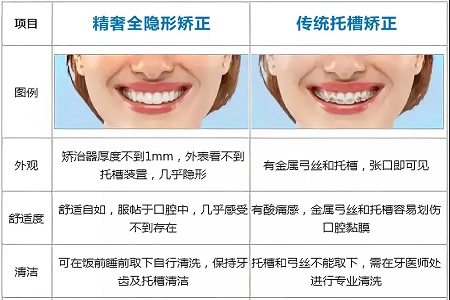 這種牙齒矯正方式，96%的人都會(huì)選擇！