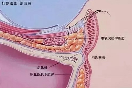 顯老淚溝，你還要任其放肆嗎？