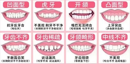 有效數(shù)據(jù)生成，預(yù)見(jiàn)牙齒矯正后的自己