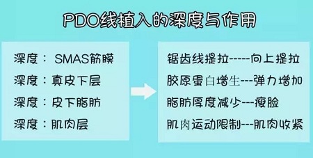 關(guān)于*雕，你想了解的都在這里！