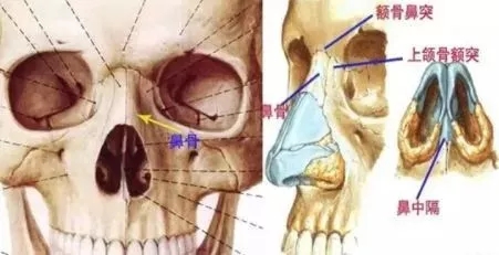 側(cè)面看鼻梁不矮,正面看鼻子卻很塌是什么原因？