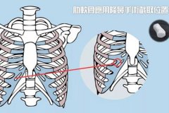 深圳隆鼻醫(yī)院做軟骨隆鼻多少錢(qián)，術(shù)后安全嗎