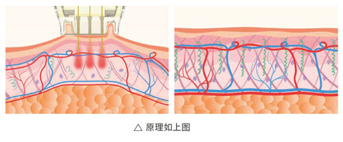 超光子+水光，“撐起”皮膚彈、潤(rùn)、緊